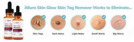 Allura Skin Tag Remov.JPG Allura Skin Tag Remov.JPG