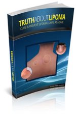 Truth About Lipoma PDF eBook by James Reynolds.jpg Truth About Lipoma PDF eBook by James Reynolds.jpg